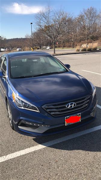 Hyundai Sonata vehicle lease transfer Mohegan Lake NY